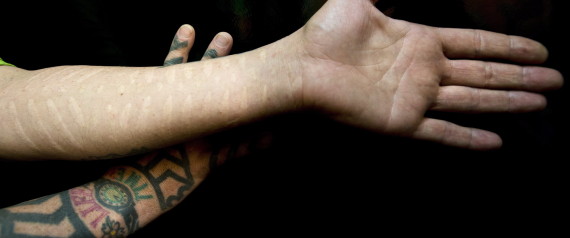 scarification_tattoos
