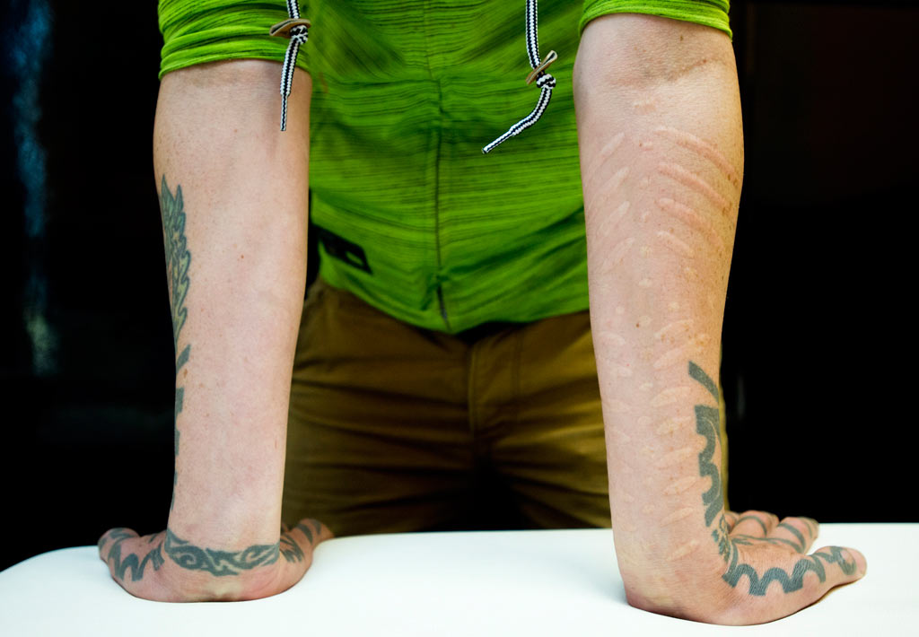 scarification_tattoos